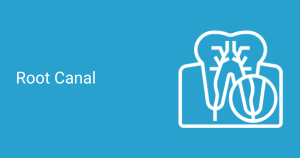 root canal therapy