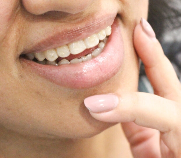 Young woman wearing clear aligners, smiling while an orthodontist works in the background.