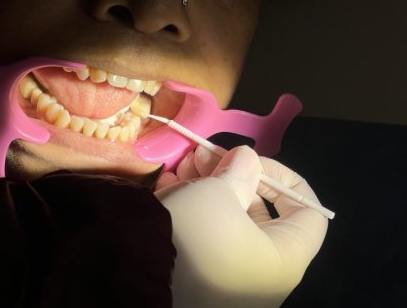 Dentist performing gum scaling and deep cleaning on patient in a modern clinic in Ghatkopar East