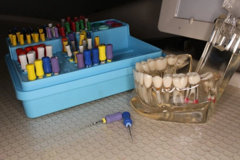 Root Canal Treatment