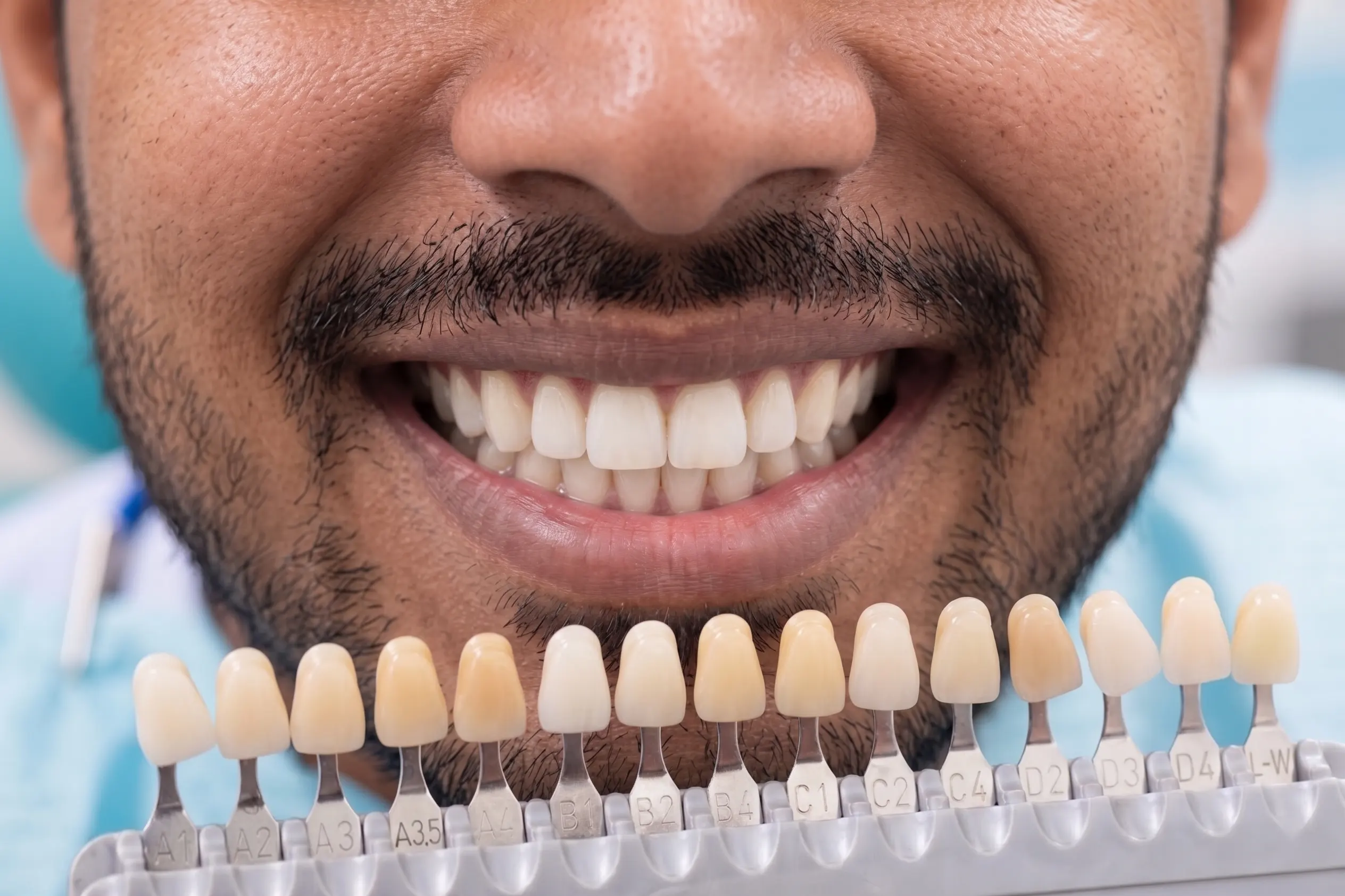Premium Veneer Materials