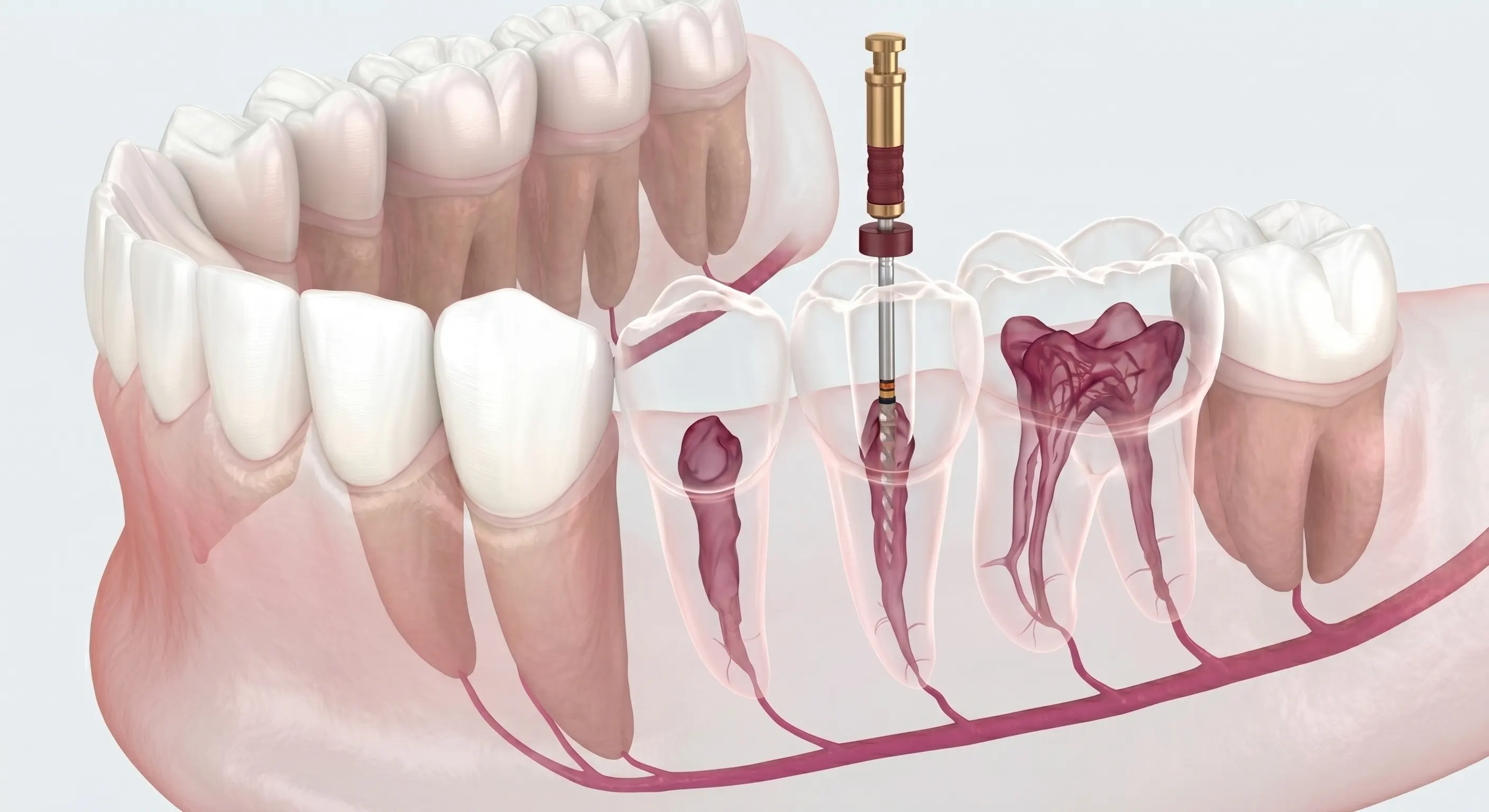 What to Eat After Root Canal Treatment: The Ultimate Food Guide for Faster Healing
